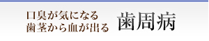 口臭が気になる 歯茎から血が出る 歯周病